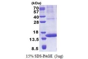 SDS-PAGE (SDS) image for Prolactin-Induced Protein (PIP) (AA 29-146) protein (His tag) (ABIN5853215)