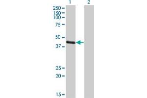Western Blot analysis of MAGEA4 expression in transfected 293T cell line by MAGEA4 polyclonal antibody (A01). (MAGEA4 anticorps  (AA 98-171))