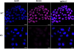 Immunocytochemical staining of HT- cells using RHOA antibody (ABIN7800142), 1:1,000), Top panel: wild-type (WT), Bottom panal: RHOA shRNA knockdown (KD). (Recombinant RHOA anticorps)