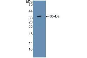 Western blot analysis of recombinant Mouse ATF1.