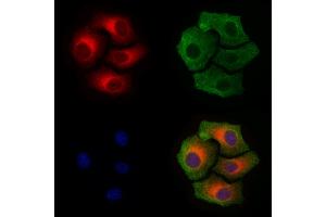 ABIN6256297 and ABIN6267410 staining Hela cells(4h of LPS treatment) by IF/ICC. (Connexin 43/GJA1 anticorps  (pSer368))
