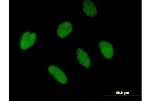 Immunofluorescence of purified MaxPab antibody to BTBD4 on HeLa cell. (ZBTB46 anticorps  (AA 1-589))