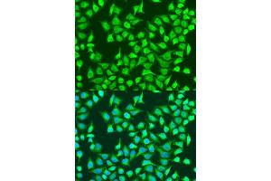 Immunofluorescence analysis of U2OS cells using SIRT4 antibody (ABIN7270326) at dilution of 1:100.