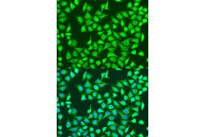 Immunofluorescence analysis of U2OS cells using SIRT4 antibody (ABIN7270326) at dilution of 1:100. (SIRT4 anticorps  (AA 1-200))