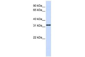 NANOS1 antibody used at 1 ug/ml to detect target protein. (Nanos Homolog 1 anticorps)