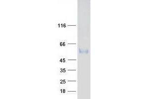Validation with Western Blot