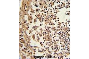 Immunohistochemistry (IHC) image for anti-Eukaryotic Translation Elongation Factor 1 delta (Guanine Nucleotide Exchange Protein) (EEF1D) antibody (ABIN3002663) (EEF1D anticorps)
