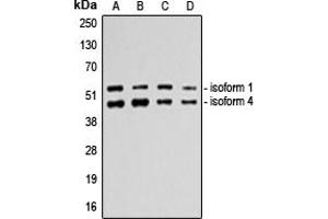 Western blot analysis of p53 expression in A549 (A), HeLa (B), MDAMB231 (C), HepG2 (D) whole cell lysates. (p53 anticorps  (C-Term))