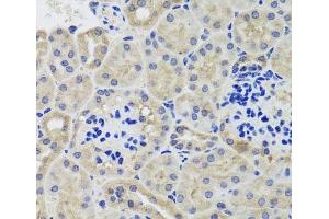 Immunohistochemistry of paraffin-embedded Mouse kidney using HK3 Polyclonal Antibody at dilution of 1:100 (40x lens). (HK3 anticorps)