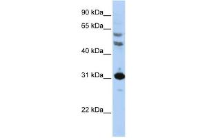 WB Suggested Anti-HOXB5 Antibody Titration: 0. (HOXB5 anticorps  (N-Term))