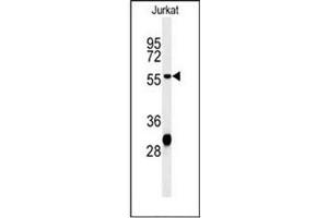 Western blot analysis of HADHB Antibody (C-term) in Jurkat cell line lysates (35ug/lane). (HADHB anticorps  (C-Term))