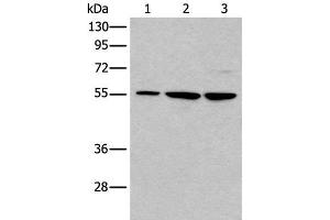 Western blot analysis of 293T and A172 cell lysates using TRIM27 Polyclonal Antibody at dilution of 1:600 (TRIM27 anticorps)