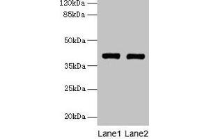 Western blot All lanes: MAB21L1 antibody at 6 μg/mL Lane 1: A375 whole cell lysate Lane 2: CEM whole cell lysate Secondary Goat polyclonal to rabbit IgG at 1/10000 dilution Predicted band size: 41 kDa Observed band size: 41 kDa (MAB21L1 anticorps  (AA 1-359))