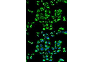 Immunofluorescence analysis of U2OS cells using RPS16 antibody. (RPS16 anticorps)