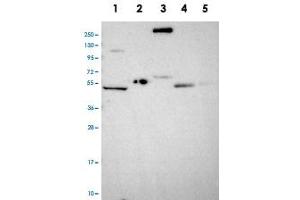 Western blot analysis of Lane 1: RT-4, Lane 2: U-251 MG, Lane 3: Human Plasma, Lane 4: Liver, Lane 5: Tonsil with COL17A1 polyclonal antibody .