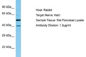 WB Suggested Anti-Hat1 Antibody   Titration: 1. (HAT1 anticorps  (N-Term))