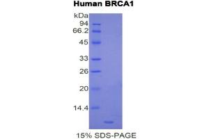 SDS-PAGE analysis of Human BRCA1 Protein.