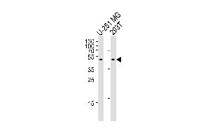 Western blot analysis of lysates from U-251 MG, 293T cell line (from left to right), using C Antibody (Center) (ABIN655405 and ABIN2844951). (CPM anticorps  (AA 212-241))