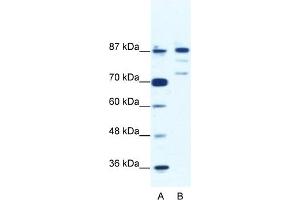 WB Suggested Anti-BACH1 Antibody Titration:  1. (BACH1 anticorps  (C-Term))