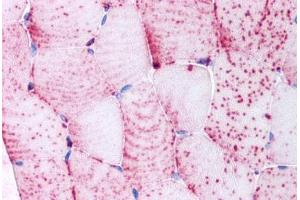 Human Skeletal Muscle, Myocytes (formalin-fixed, paraffin-embedded) stained with TNIK antibody ABIN213549 at 5 ug/ml followed by biotinylated goat anti-rabbit IgG secondary antibody ABIN481713, alkaline phosphatase-streptavidin and chromogen.