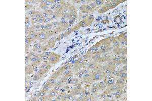 Immunohistochemistry of paraffin-embedded human liver injury using μgT2B10 antibody (ABIN5975607) at dilution of 1/100 (40x lens). (UGT2B10 anticorps)