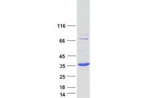 Validation with Western Blot