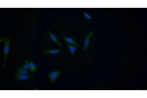 Detection of GSTM1 in Human HepG2 cell using Polyclonal Antibody to Glutathione S Transferase Mu 1 (GSTM1) (GSTM1 anticorps  (AA 1-220))