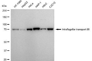 anti-Intraflagellar Transport 88 Homolog (IFT88) antibody