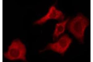 ABIN6276242 staining HepG2 by IF/ICC.