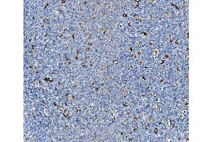 IHC analysis of NPC2 using anti-NPC2 antibody (ABIN7600520).