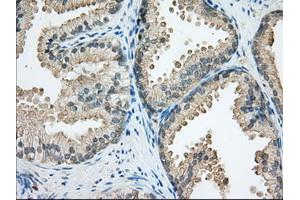 Immunohistochemistry (IHC) image for anti-Sorting Nexin 9 (SNX9) antibody (ABIN1501045)
