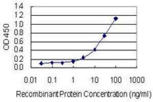 Detection limit for recombinant GST tagged GAD2 is 0.