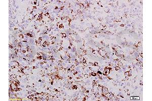 Formalin-fixed and paraffin embedded mouse lung labeled with Rabbit Anti PRAME Polyclonal Antibody, Unconjugated (ABIN721555) at 1:200 followed by conjugation to the secondary antibody and DAB staining (PRAME anticorps  (AA 151-250))