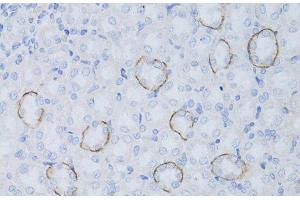 Immunohistochemistry of paraffin-embedded Rat kidney using Aquaporin 4 Polyclonal Antibody at dilution of 1:50 (40x lens). (Aquaporin 4 anticorps)