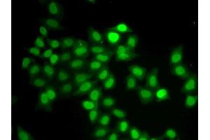 Immunofluorescence analysis of U2OS cells using MAD1L1 antibody. (MAD1L1 anticorps  (AA 360-700))