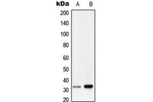 anti-Ras-Related Associated with Diabetes (RRAD) (Center) antibody