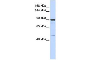 PDE3B antibody used at 1 ug/ml to detect target protein. (PDE3B anticorps  (Middle Region))