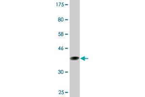 Western Blot detection against Immunogen (37. (CENPJ anticorps  (AA 979-1088))