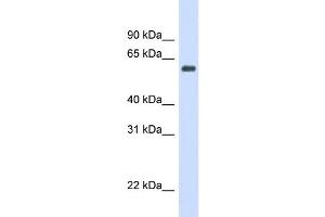 WB Suggested Anti-CAT Antibody Titration: 0. (Catalase anticorps  (Middle Region))
