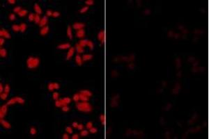 ABIN190786 (2. (ILF2 anticorps  (Internal Region))