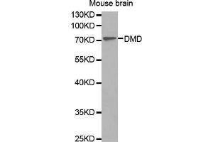 Western Blotting (WB) image for anti-Dystrophin (DMD) (AA 346-635) antibody (ABIN1679546) (Dystrophin anticorps  (AA 346-635))