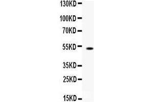 Western blot analysis of FCGRT expression in mouse liver extract (lane 1). (FcRn anticorps  (AA 54-291))