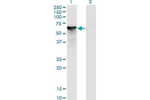 Western Blot analysis of SF1 expression in transfected 293T cell line by SF1 monoclonal antibody (M01A), clone 2E12. (Splicing Factor 1 anticorps  (AA 1-110))