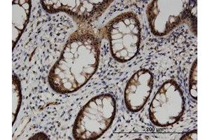 Image no. 1 for anti-Acyl-CoA Thioesterase 7 (ACOT7) (AA 1-339) antibody (ABIN599527) (ACOT7 anticorps  (AA 1-339))