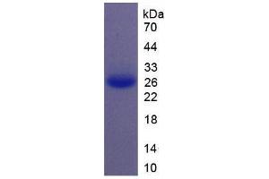 Image no. 2 for Interleukin 11 (IL11) (AA 22-199) (Active) protein (His tag) (ABIN5665838) (IL-11 Protein (AA 22-199) (His tag))