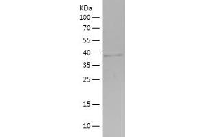 Western Blotting (WB) image for Phosphorylase, Glycogen, Muscle (PYGM) (AA 64-197) protein (His-IF2DI Tag) (ABIN7124447)