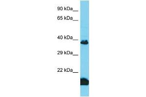 Host: Rabbit Target Name: TAS2R3 Sample Type: Fetal Kidney lysates Antibody Dilution: 1. (TAS2R3 anticorps  (Middle Region))