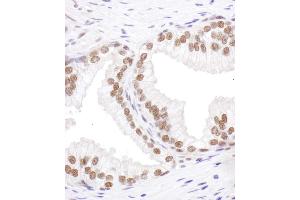 Immunohistochemistry (IHC) image for anti-serine/arginine-Rich Splicing Factor 6 (SRSF6) (AA 250-300) antibody (ABIN7454941)