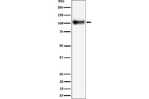 Western blot analysis of Thrombomodulin / CD141 expression in mouse lung cell lysate.