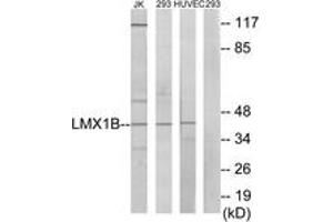 Western blot analysis of extracts from Jurkat/293/HuvEc cells, using LMX1B Antibody. (LMX1B anticorps  (AA 126-175))